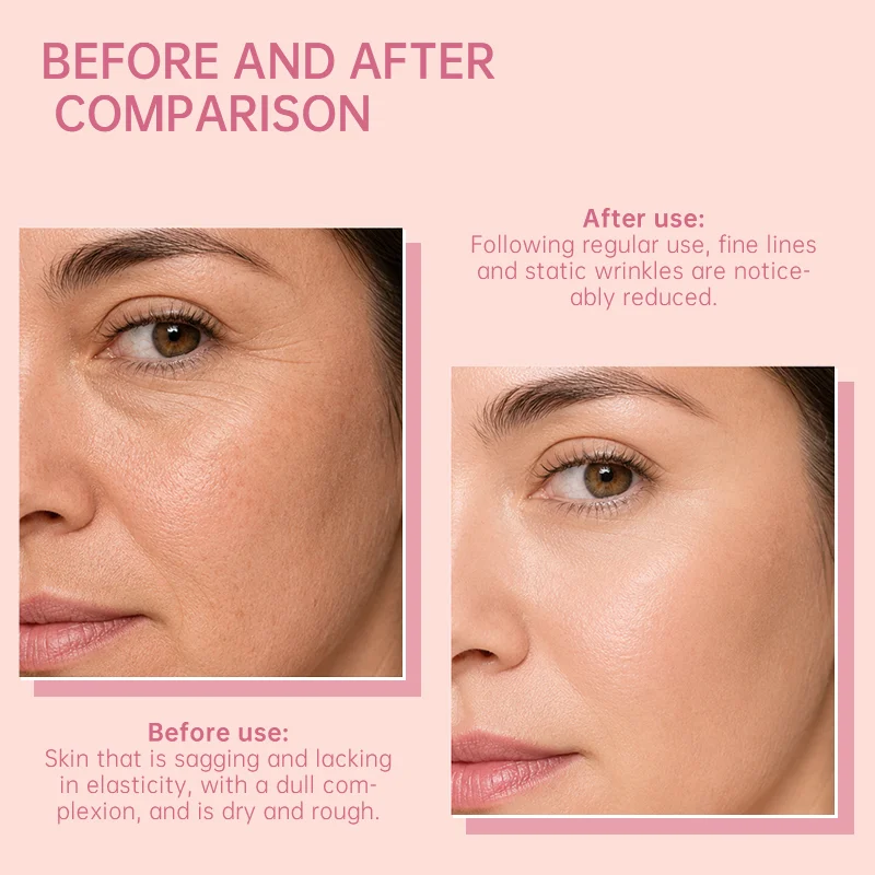 Side-by-side comparison of a woman's face showing skin improvement, with reduced fine lines and wrinkles after regular skincare use.